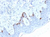 FFPE human skin sections stained with 100 ul anti-gp100 (clone PMEL/2038) at 1:300. HIER epitope retrieval prior to staining was performed in 10mM Citrate, pH 6.0.